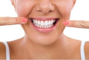 Lady pointing to her straight teeth after her braces were removed | Avalon Dental, your Carson and El Segundo Dentist