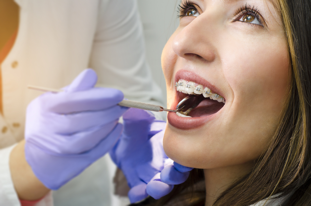 Image of a Woman getting her braces check by a dentist | Avalon Dental, your Carson and El Segundo Dentist