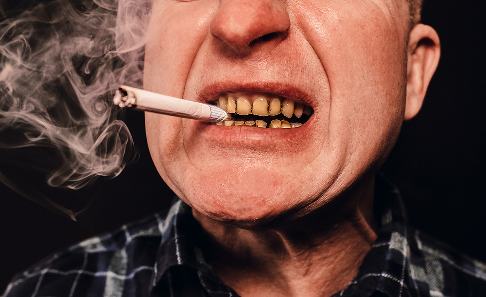 How Does Smoking Affect My Oral Health?