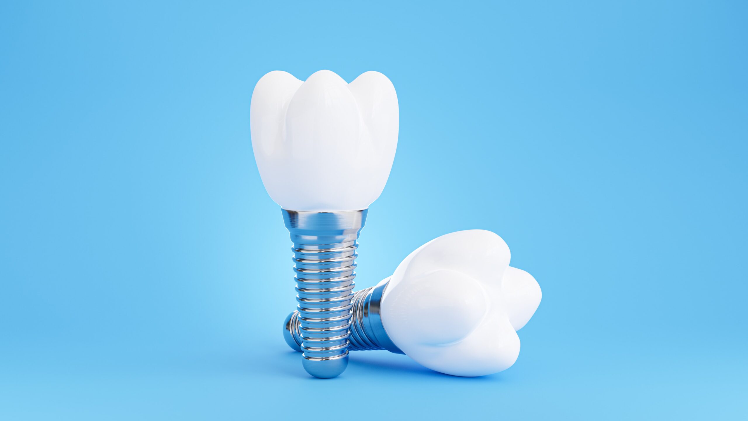 5 Reasons to Consider Dental Implants