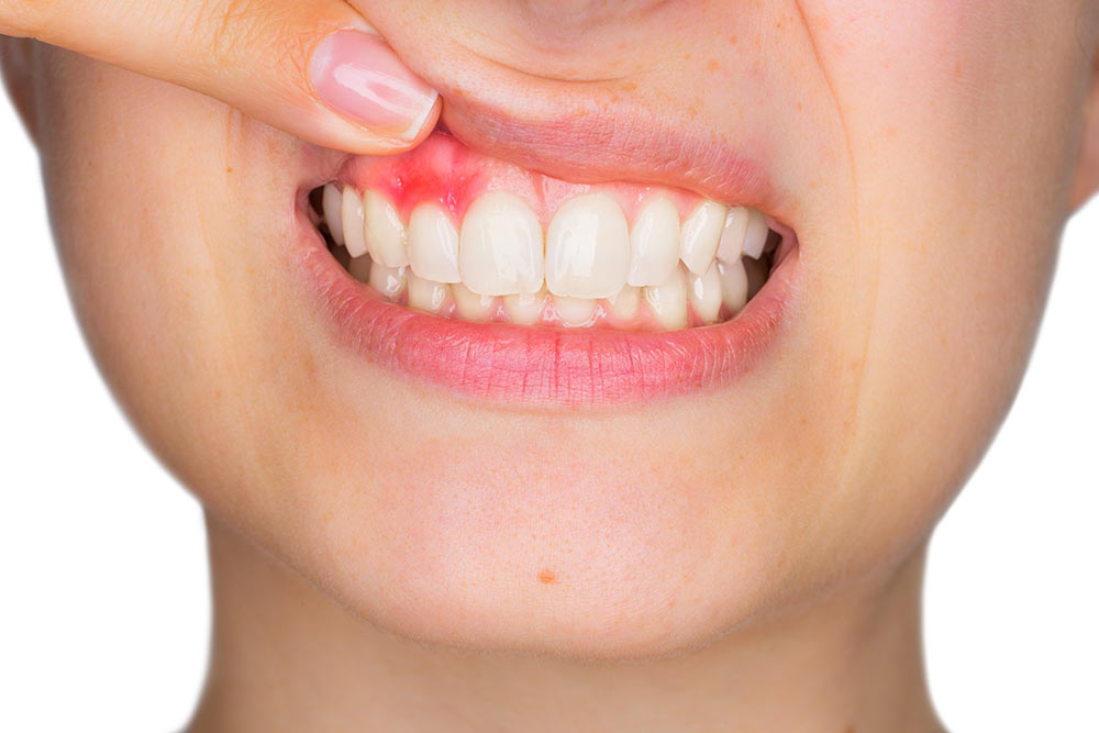 Dentist examining an older adult's stained teeth, highlighting increased susceptibility to tooth staining in older adults